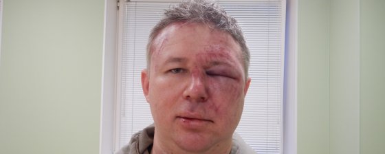 «Методично били по голове, преимущественно ногами»